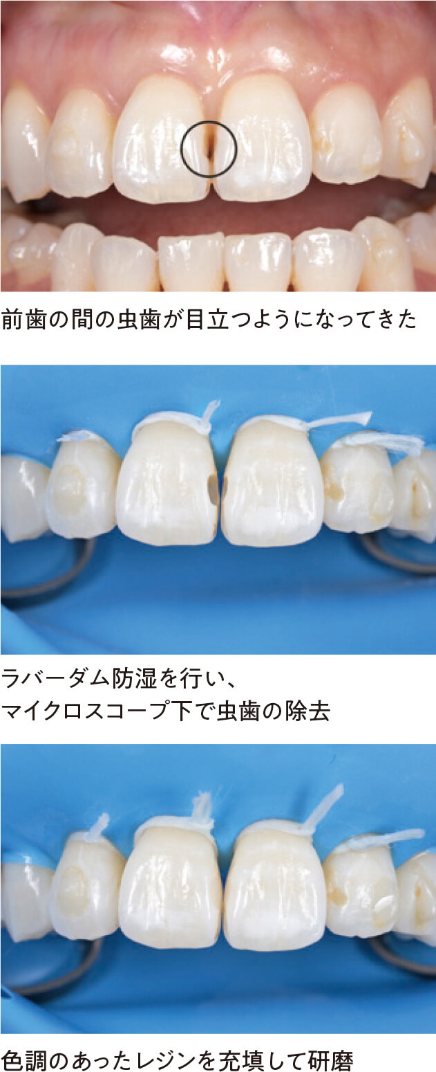 関口歯科 川越、歯医者、歯科医、歯周病、根管治療、入れ歯（義歯）、審美歯科・セラミック治療、自由診療