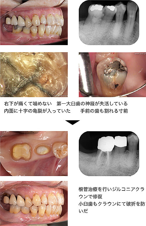 関口歯科 川越、歯医者、歯科医、歯周病、根管治療、入れ歯（義歯）、審美歯科・セラミック治療、自由診療