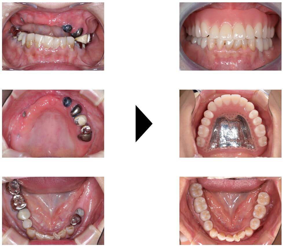 関口歯科 川越、歯医者、歯科医、歯周病、根管治療、入れ歯（義歯）、審美歯科・セラミック治療、自由診療