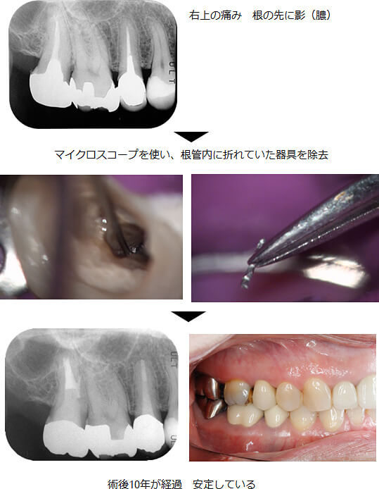 関口歯科 川越、歯医者、歯科医、歯周病、根管治療、入れ歯(義歯)、審美歯科・セラミック治療、自由診療