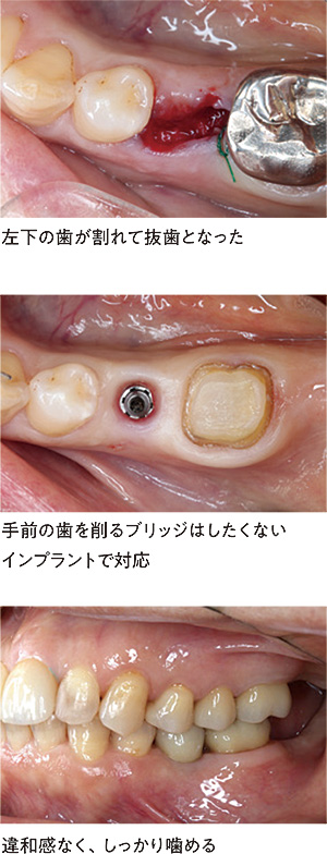 関口歯科 川越、歯医者、歯科医、歯周病、根管治療、入れ歯(義歯)、審美歯科・セラミック治療、自由診療