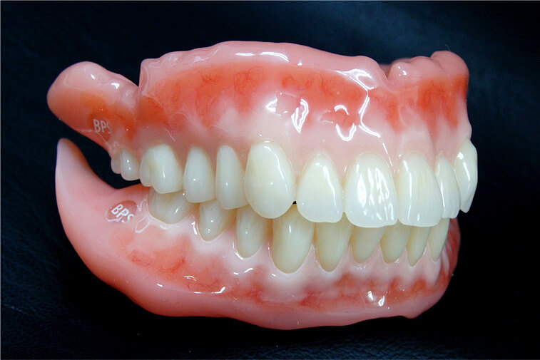 関口歯科で作成したBPSデンチャー