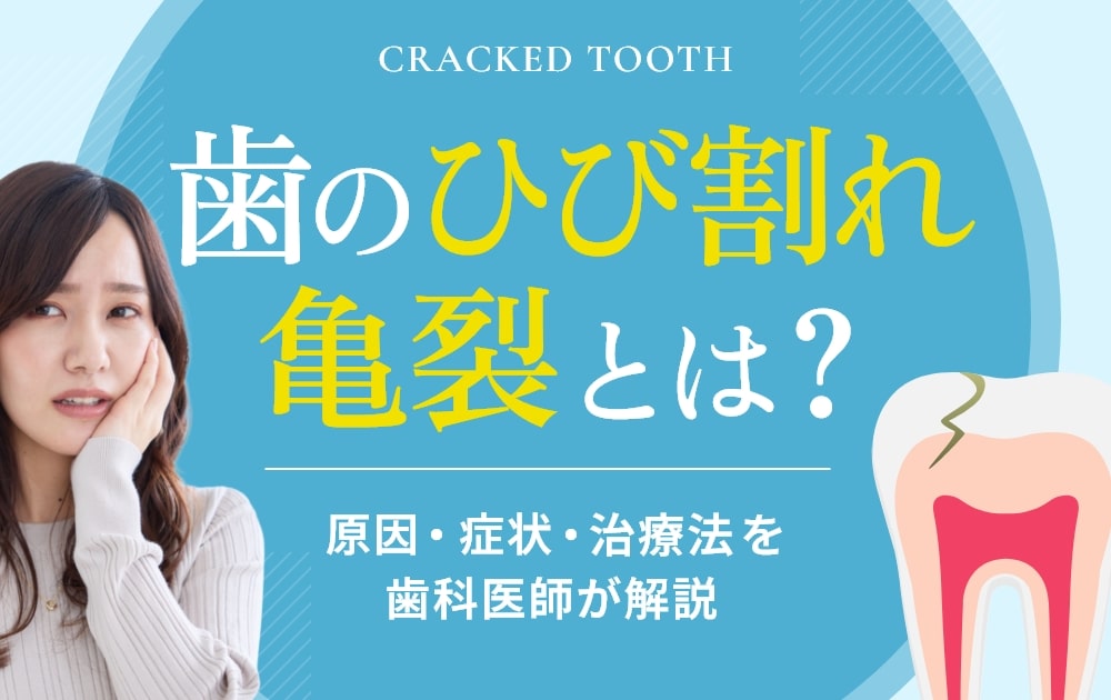 歯　ひび割れ
