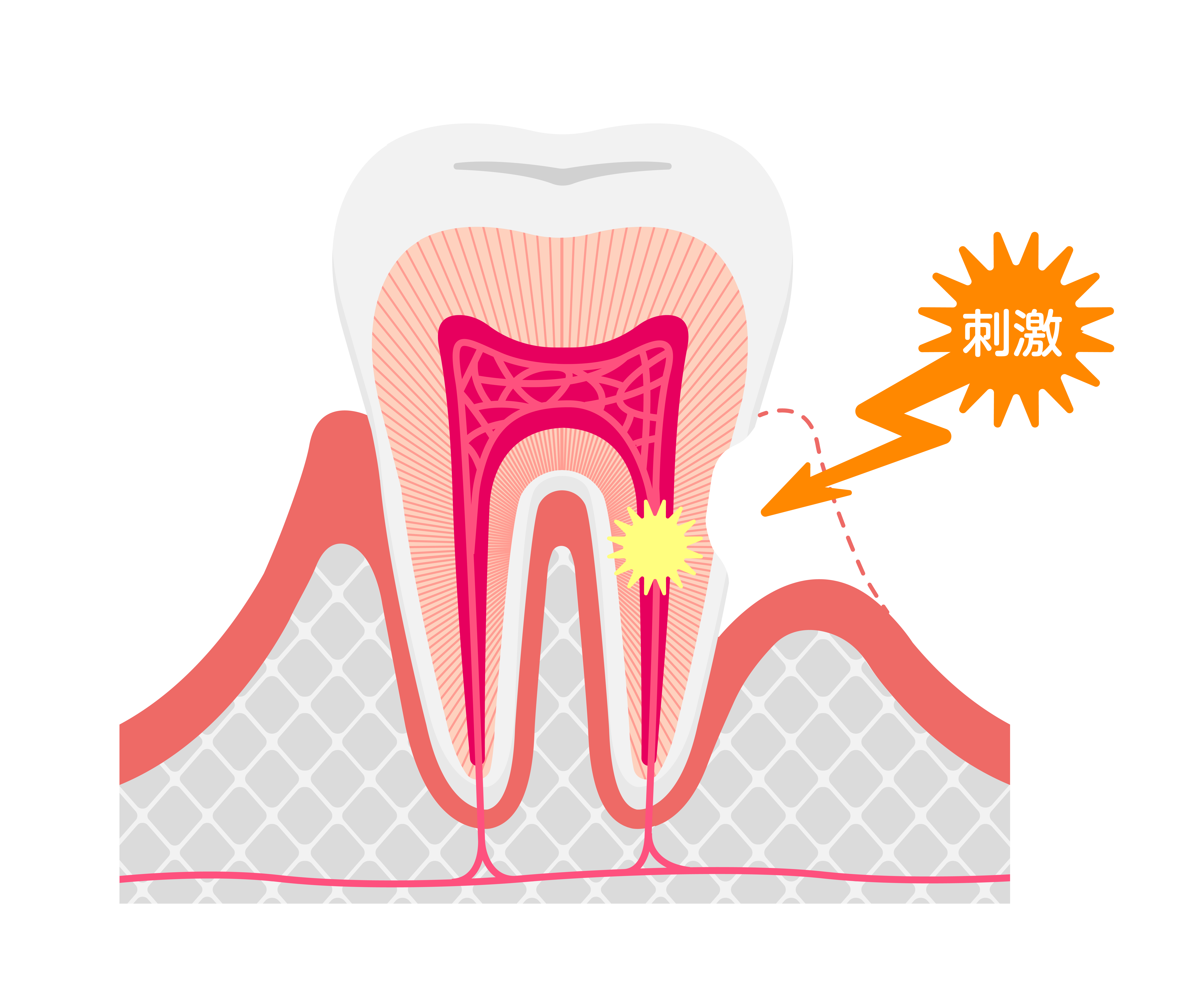 歯の神経の図解