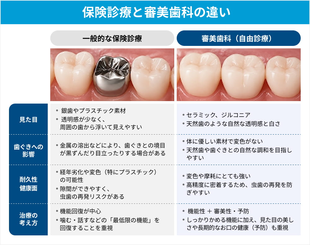 一般歯科（保険診療）と審美歯科（自由診療）の違い