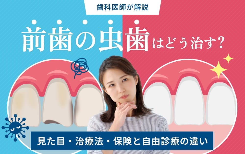前歯 虫歯