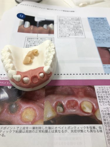 関口歯科 川越、歯医者、歯科医、歯周病、根管治療、入れ歯（義歯）、審美歯科・セラミック治療、自由診療