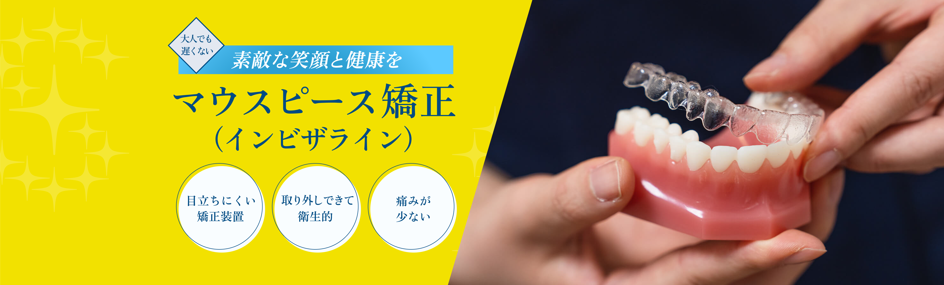 マウスピース矯正（インビザライン）