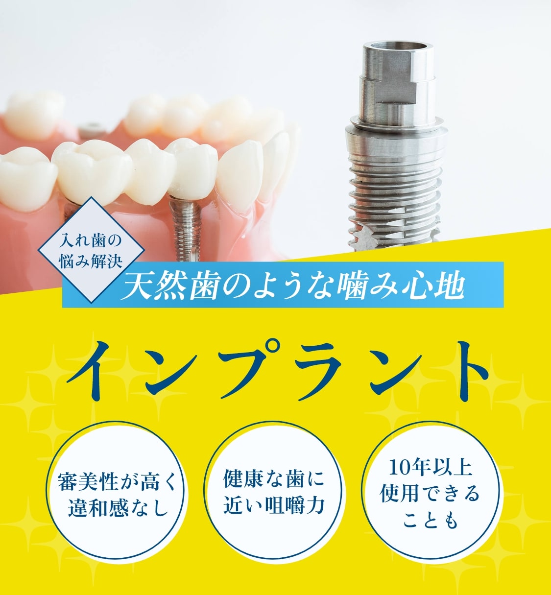 インプラント
