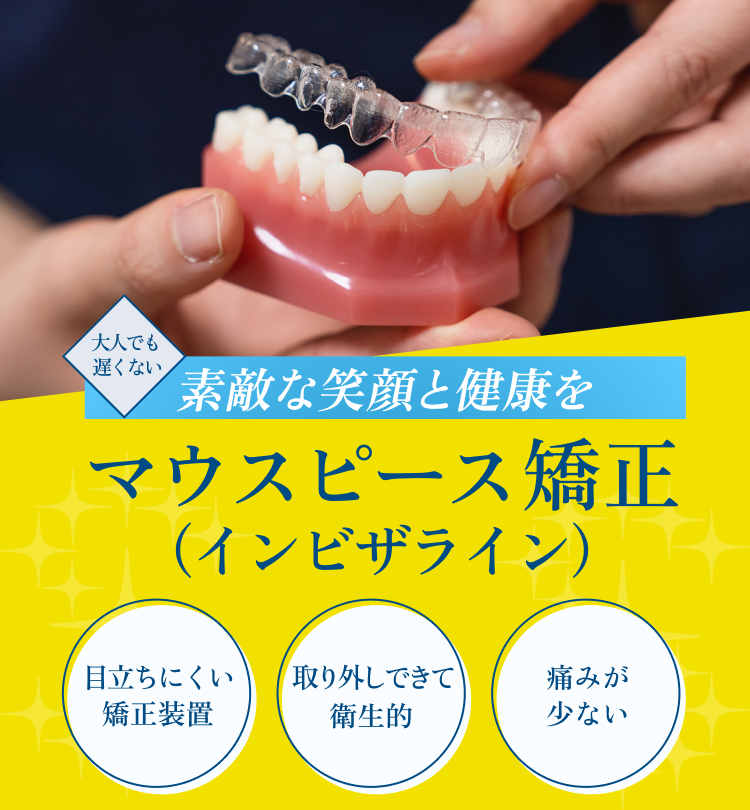 マウスピース矯正（インビザライン）