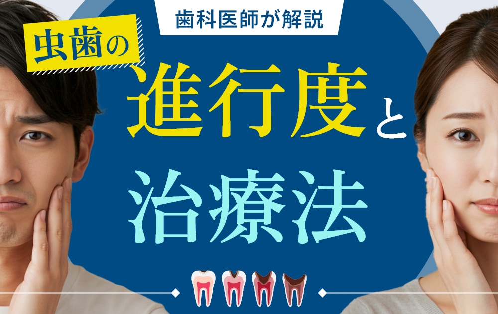 虫歯の進行度と治療法が気になる男女