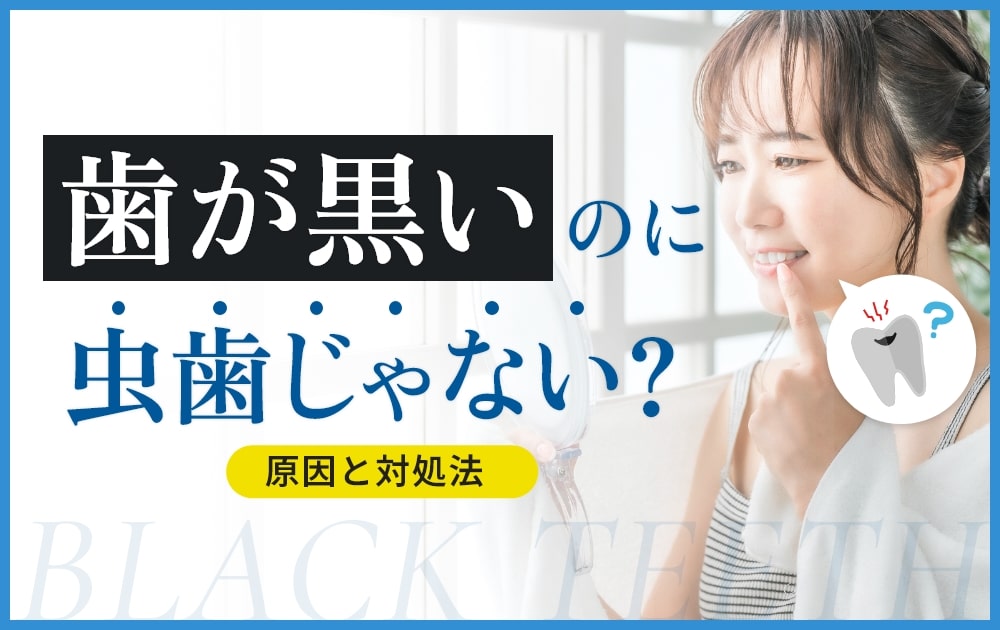 歯が黒い　虫歯