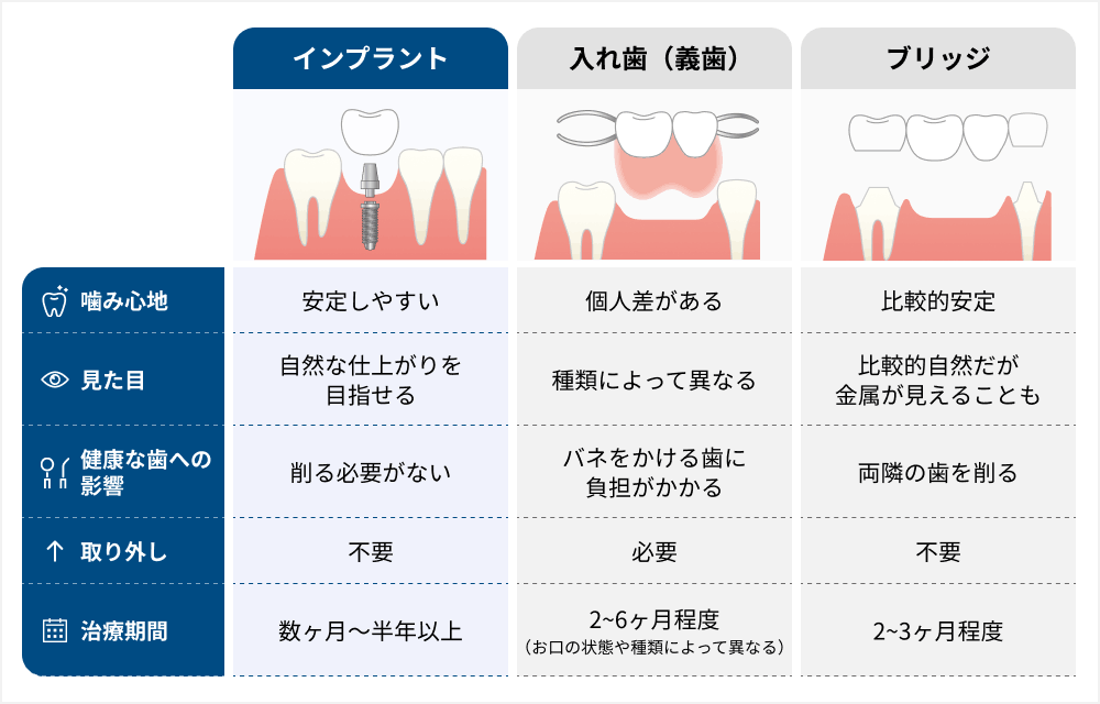インプラント・入れ歯・ブリッジの違い