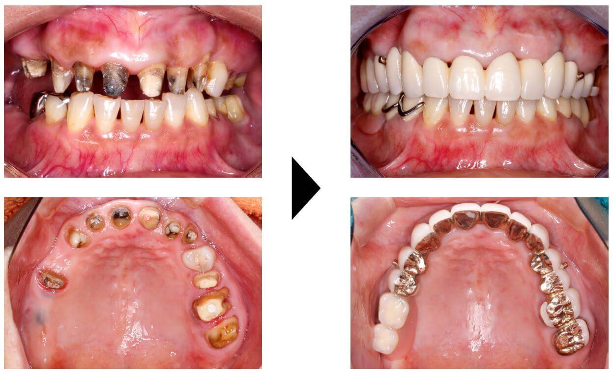 関口歯科 川越、歯医者、歯科医、歯周病、根管治療、入れ歯(義歯)、審美歯科・セラミック治療、自由診療