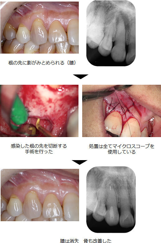関口歯科 川越、歯医者、歯科医、歯周病、根管治療、入れ歯(義歯)、審美歯科・セラミック治療、自由診療
