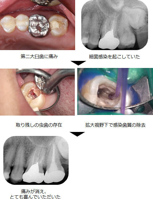 関口歯科 川越、歯医者、歯科医、歯周病、根管治療、入れ歯(義歯)、審美歯科・セラミック治療、自由診療