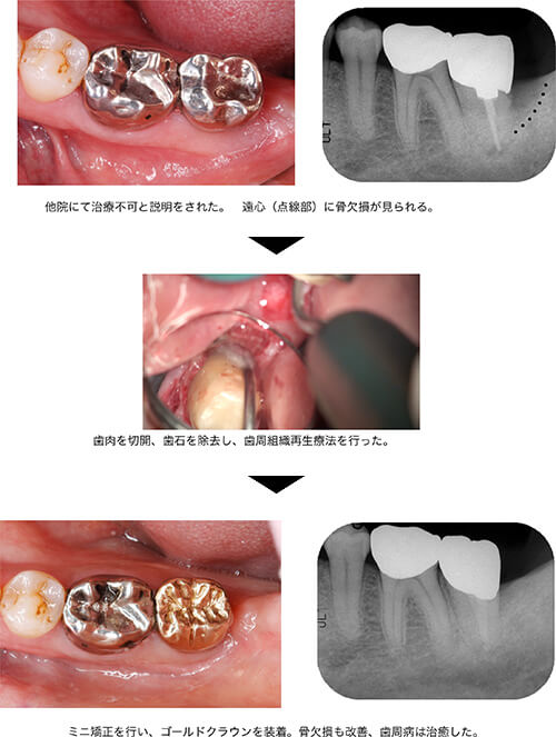 関口歯科 川越、歯医者、歯科医、歯周病、根管治療、入れ歯(義歯)、審美歯科・セラミック治療、自由診療