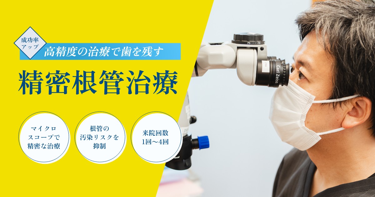 精密根管治療
