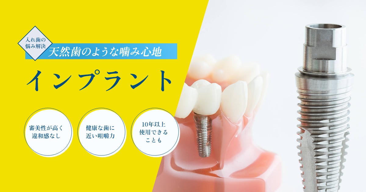 インプラント