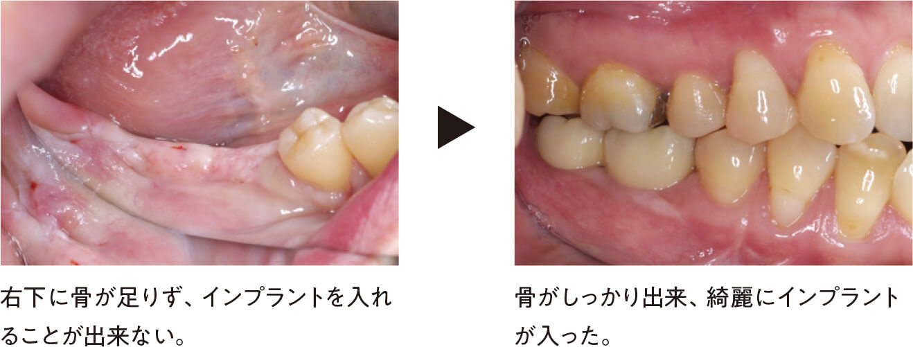 関口歯科 川越、歯医者、歯科医、歯周病、根管治療、入れ歯(義歯)、審美歯科・セラミック治療、自由診療