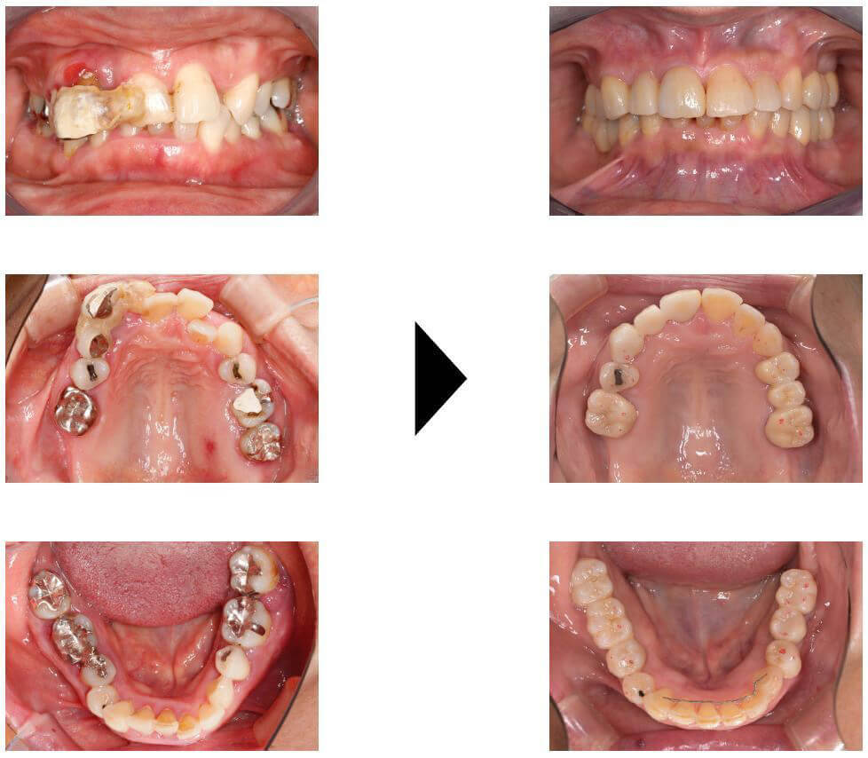 関口歯科 川越、歯医者、歯科医、歯周病、根管治療、入れ歯(義歯)、審美歯科・セラミック治療、自由診療