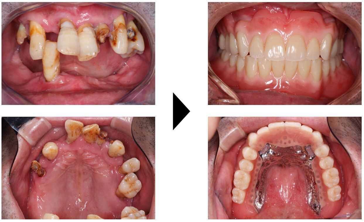 関口歯科 川越、歯医者、歯科医、歯周病、根管治療、入れ歯(義歯)、審美歯科・セラミック治療、自由診療