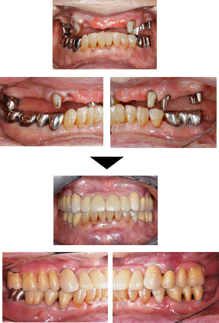 関口歯科 川越、歯医者、歯科医、歯周病、根管治療、入れ歯(義歯)、審美歯科・セラミック治療、自由診療