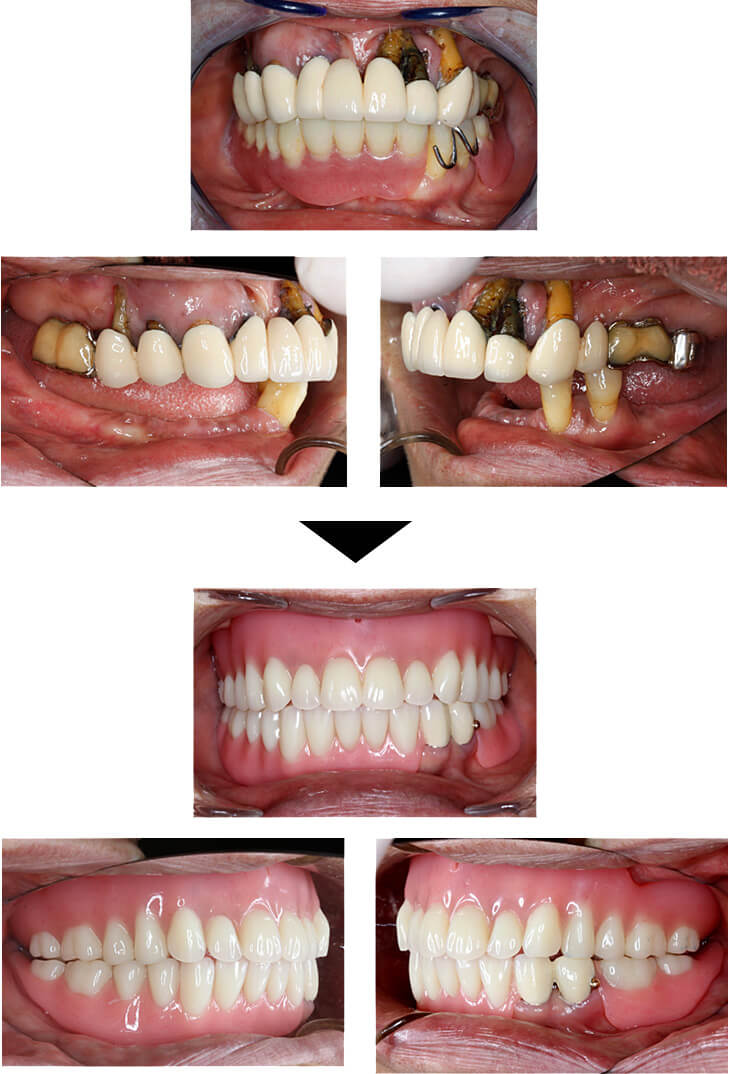 関口歯科 川越、歯医者、歯科医、歯周病、根管治療、入れ歯(義歯)、審美歯科・セラミック治療、自由診療