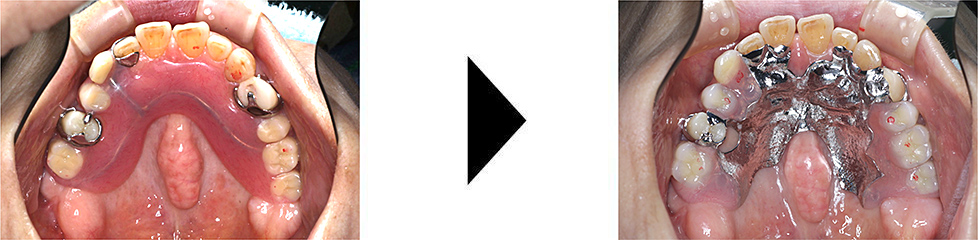 関口歯科 川越、歯医者、歯科医、歯周病、根管治療、入れ歯(義歯)、審美歯科・セラミック治療、自由診療