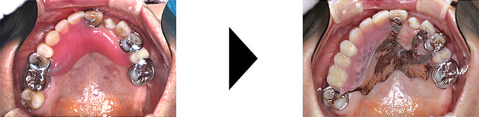 関口歯科 川越、歯医者、歯科医、歯周病、根管治療、入れ歯(義歯)、審美歯科・セラミック治療、自由診療