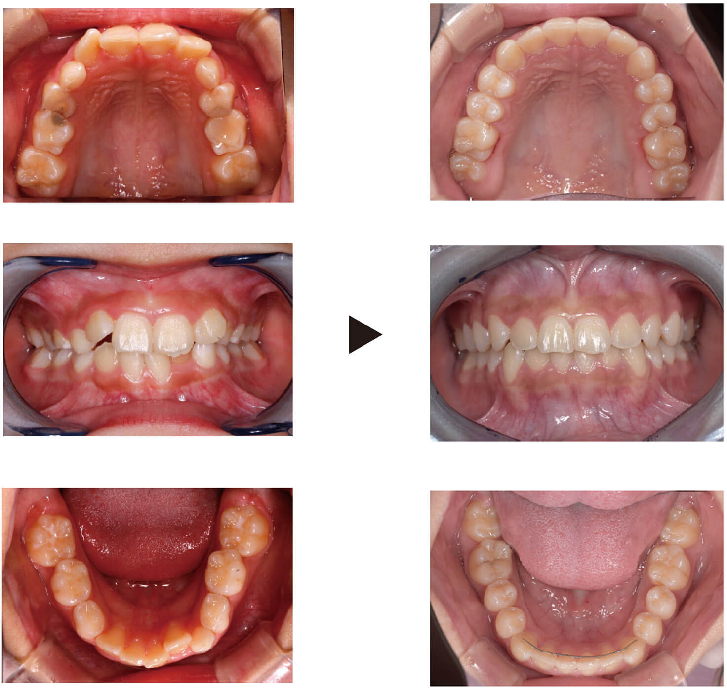 関口歯科 川越、歯医者、歯科医、歯周病、根管治療、入れ歯(義歯)、審美歯科・セラミック治療、自由診療