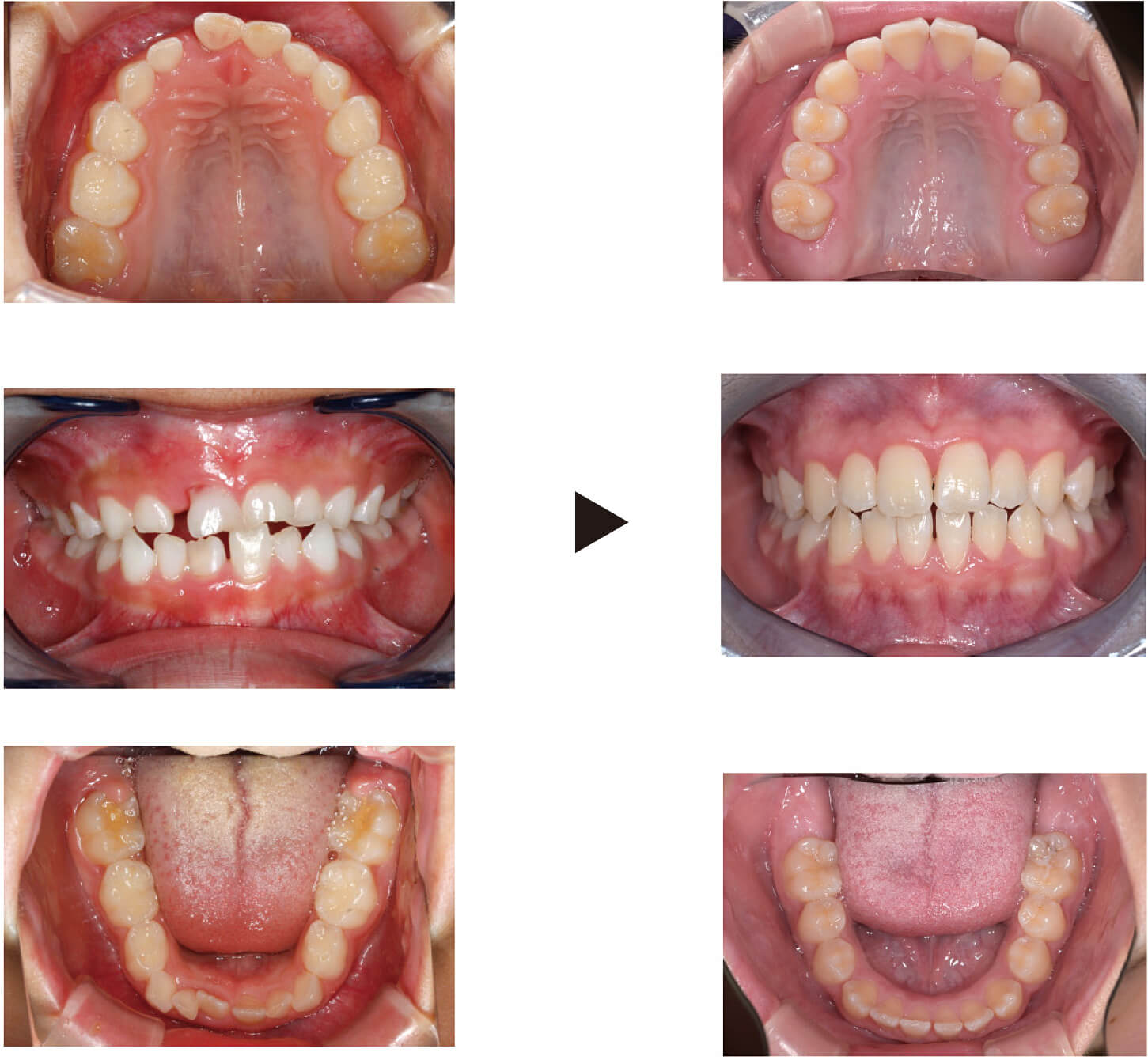 関口歯科 川越、歯医者、歯科医、歯周病、根管治療、入れ歯(義歯)、審美歯科・セラミック治療、自由診療
