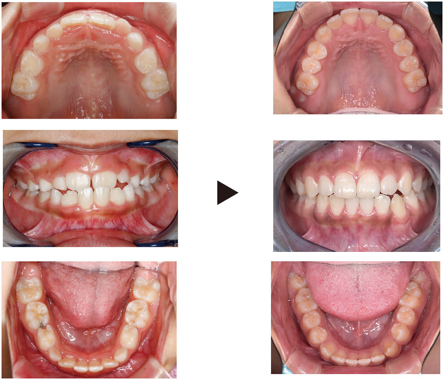 関口歯科 川越、歯医者、歯科医、歯周病、根管治療、入れ歯(義歯)、審美歯科・セラミック治療、自由診療