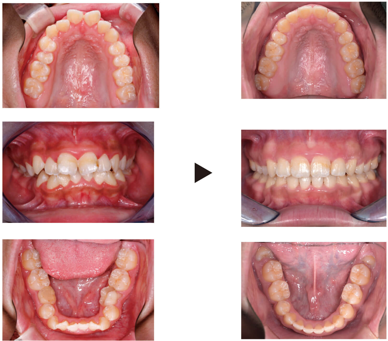 関口歯科 川越、歯医者、歯科医、歯周病、根管治療、入れ歯(義歯)、審美歯科・セラミック治療、自由診療