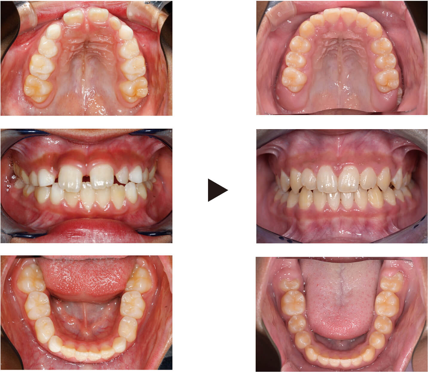 関口歯科 川越、歯医者、歯科医、歯周病、根管治療、入れ歯(義歯)、審美歯科・セラミック治療、自由診療