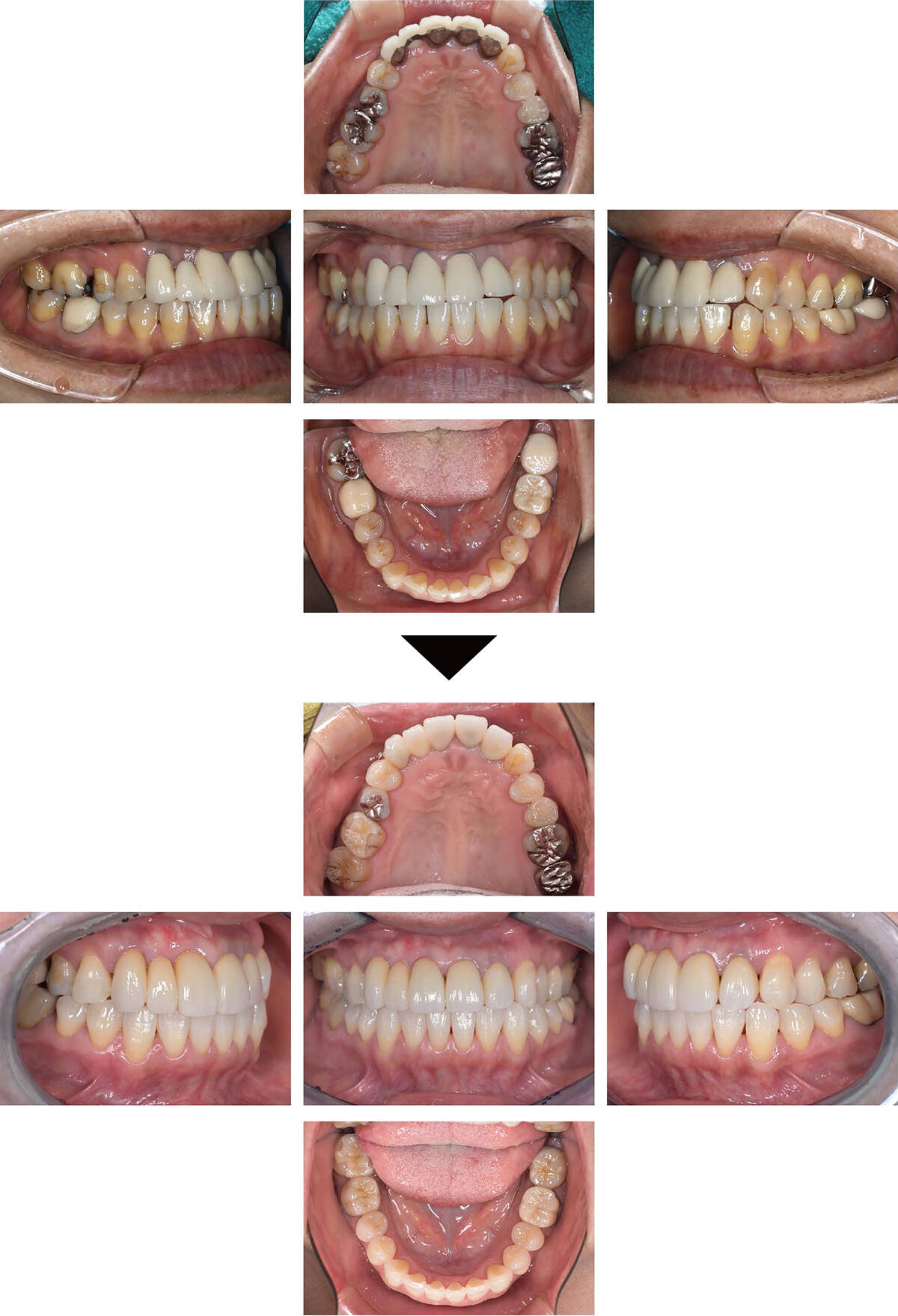 関口歯科 川越、歯医者、歯科医、歯周病、根管治療、入れ歯(義歯)、審美歯科・セラミック治療、自由診療