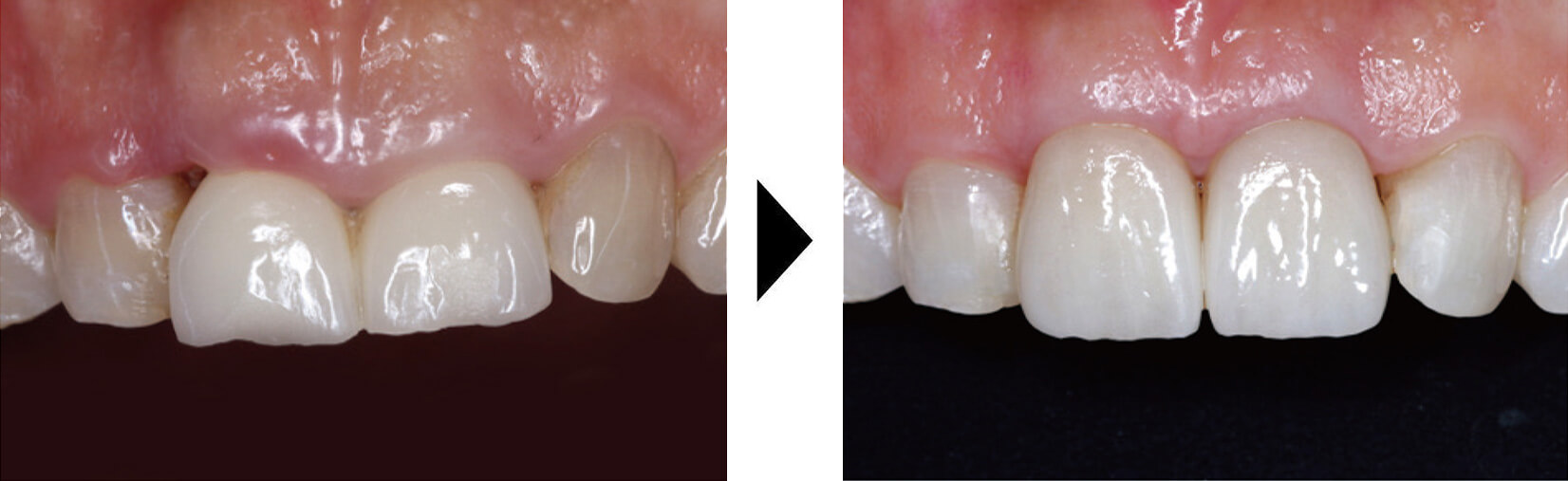 関口歯科 川越、歯医者、歯科医、歯周病、根管治療、入れ歯(義歯)、審美歯科・セラミック治療、自由診療