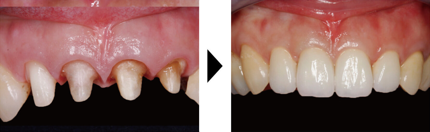 関口歯科 川越、歯医者、歯科医、歯周病、根管治療、入れ歯(義歯)、審美歯科・セラミック治療、自由診療