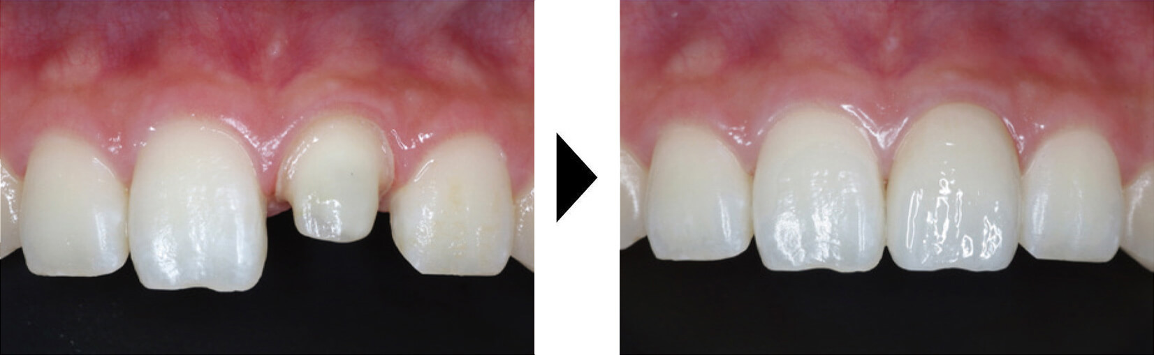 関口歯科 川越、歯医者、歯科医、歯周病、根管治療、入れ歯(義歯)、審美歯科・セラミック治療、自由診療