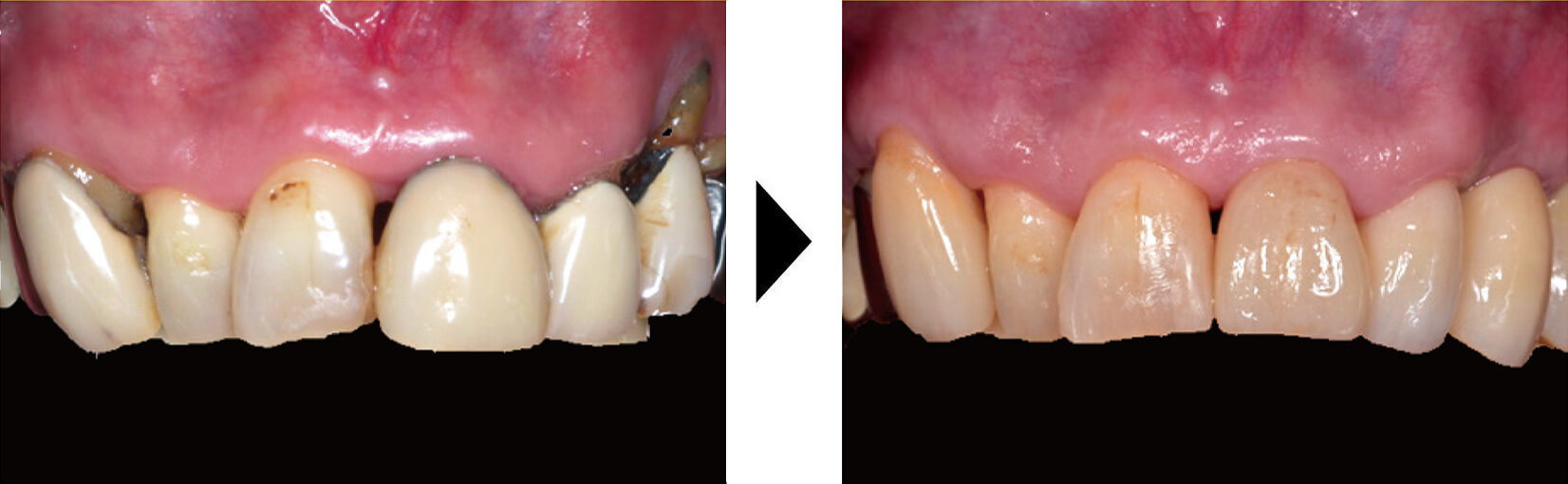 関口歯科 川越、歯医者、歯科医、歯周病、根管治療、入れ歯(義歯)、審美歯科・セラミック治療、自由診療