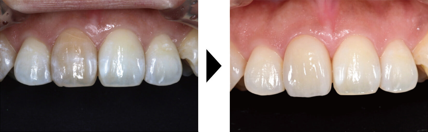 関口歯科 川越、歯医者、歯科医、歯周病、根管治療、入れ歯(義歯)、審美歯科・セラミック治療、自由診療