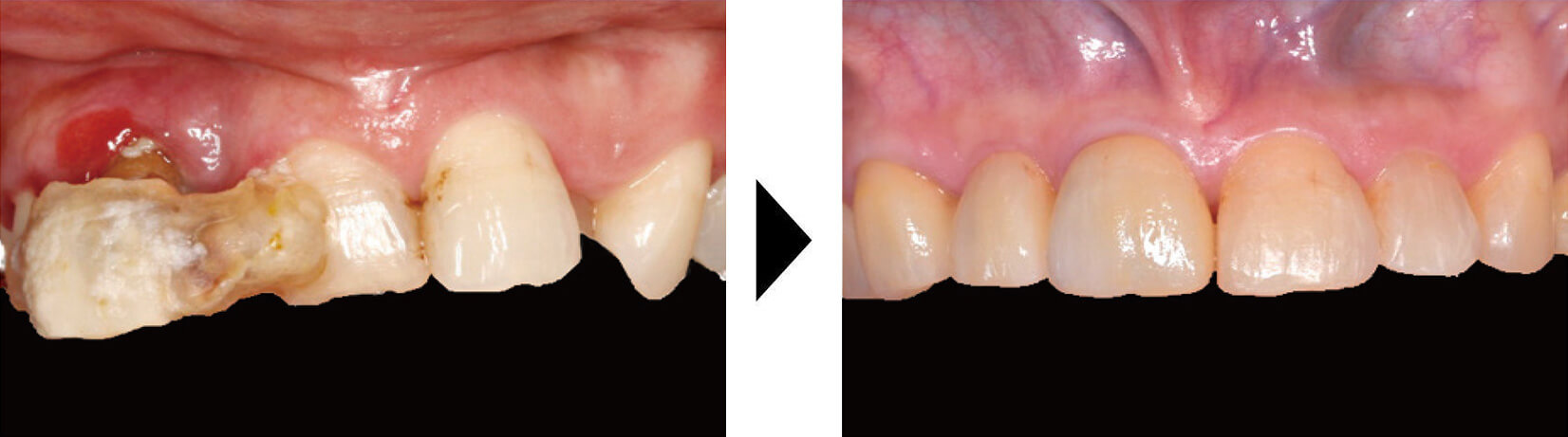 関口歯科 川越、歯医者、歯科医、歯周病、根管治療、入れ歯(義歯)、審美歯科・セラミック治療、自由診療