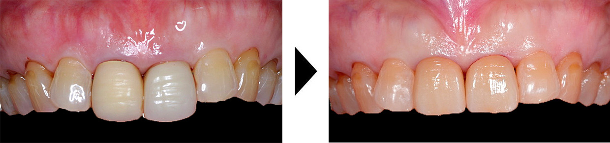 関口歯科 川越、歯医者、歯科医、歯周病、根管治療、入れ歯(義歯)、審美歯科・セラミック治療、自由診療