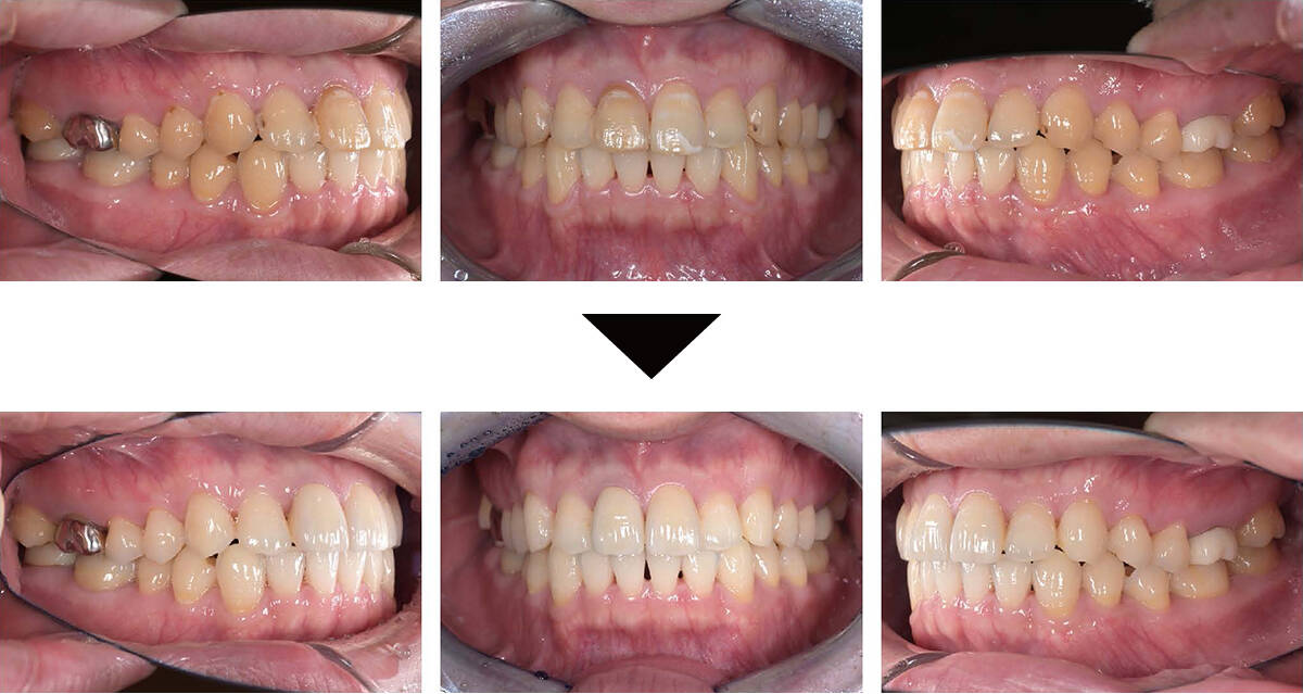 関口歯科 川越、歯医者、歯科医、歯周病、根管治療、入れ歯(義歯)、審美歯科・セラミック治療、自由診療