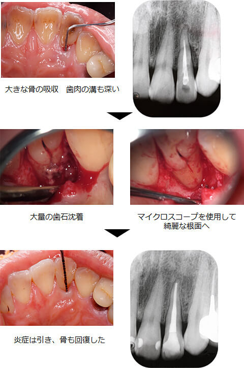 関口歯科 川越、歯医者、歯科医、歯周病、根管治療、入れ歯(義歯)、審美歯科・セラミック治療、自由診療