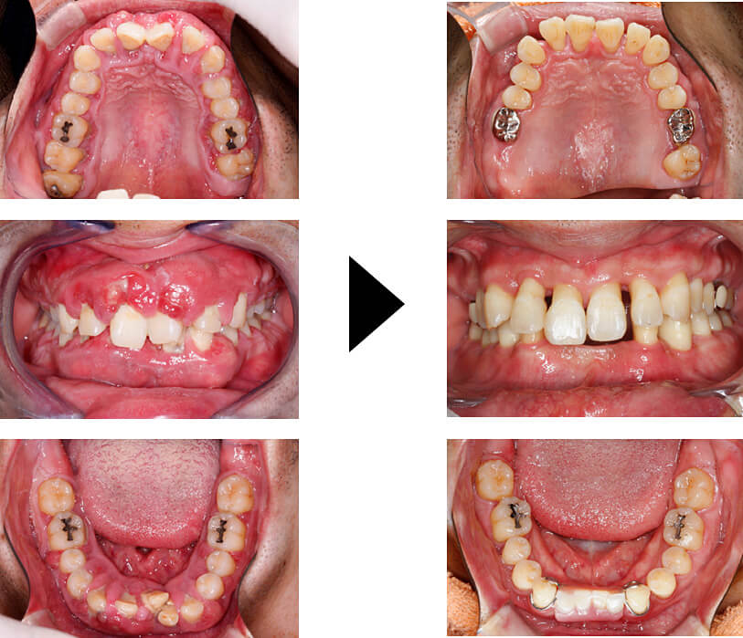 関口歯科 川越、歯医者、歯科医、歯周病、根管治療、入れ歯(義歯)、審美歯科・セラミック治療、自由診療