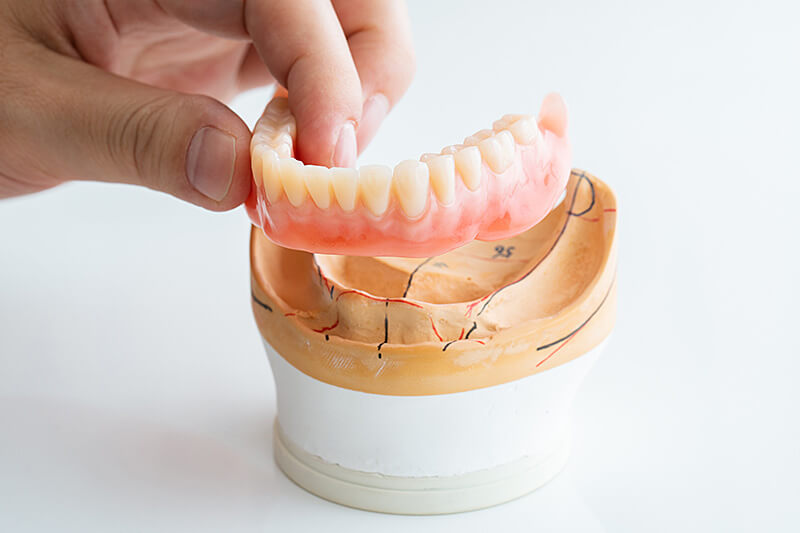義歯を持つ手