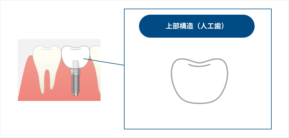 上部構造