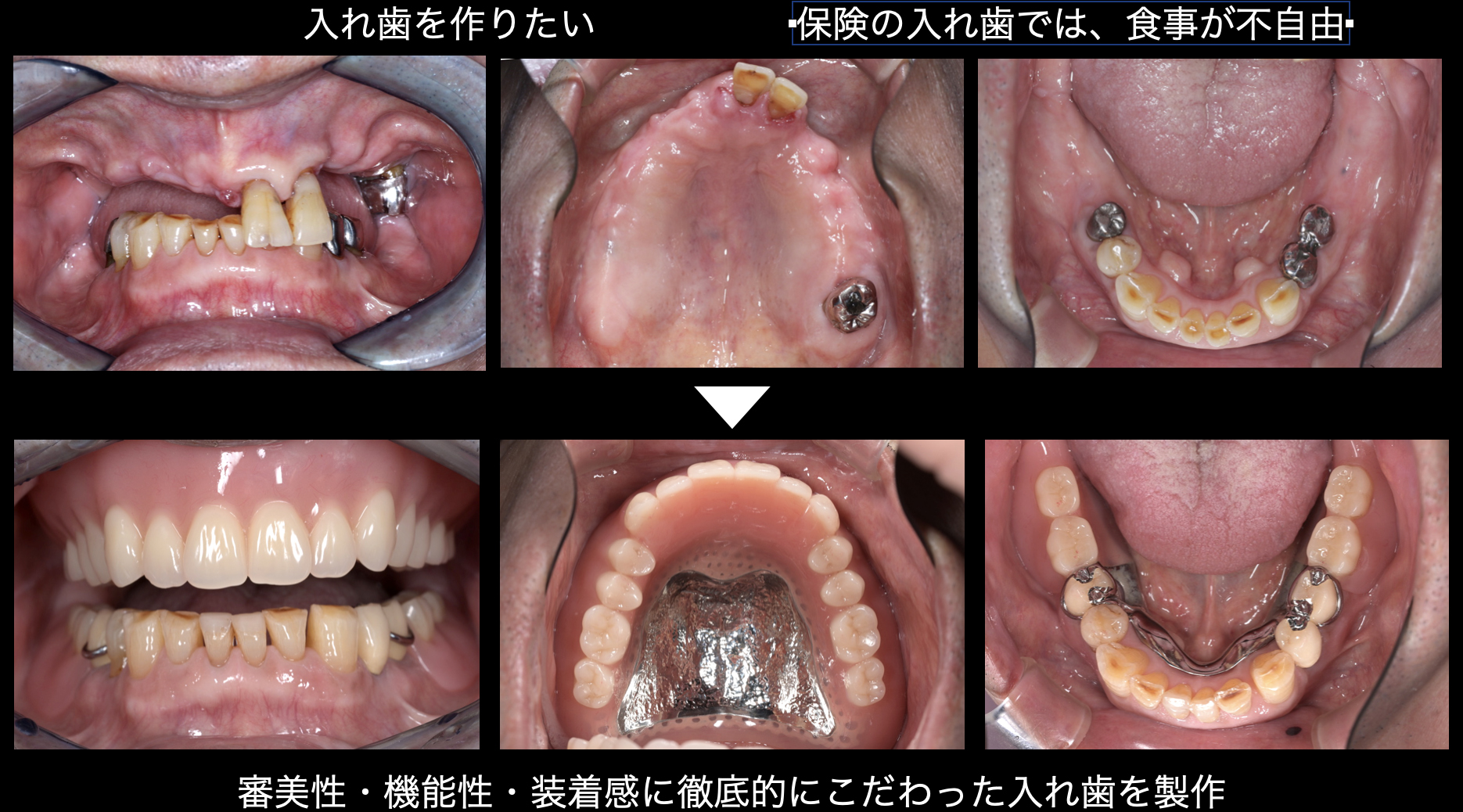 関口歯科 川越、歯医者、歯科医、歯周病、根管治療、入れ歯(義歯)、審美歯科・セラミック治療、自由診療
