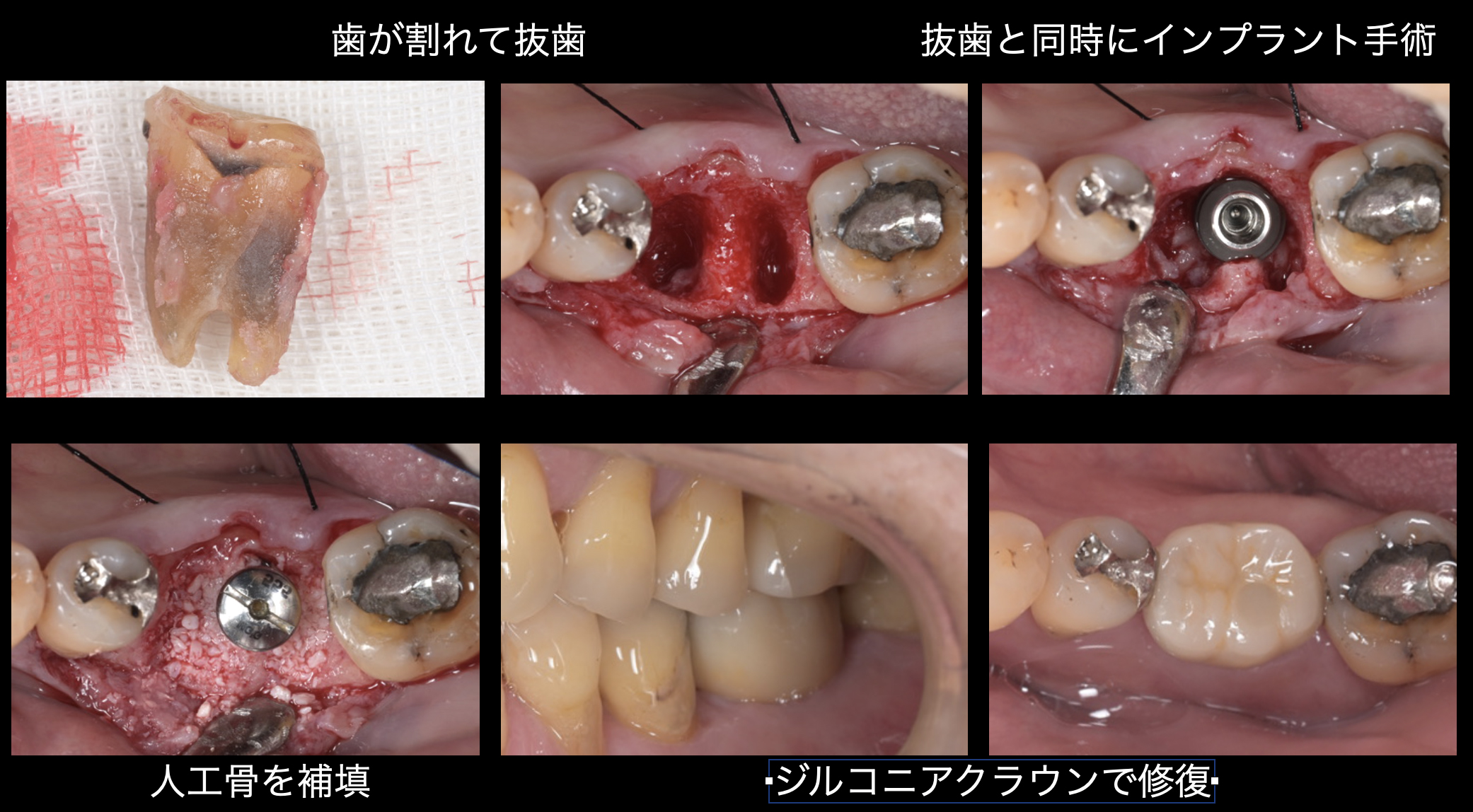 関口歯科 川越、歯医者、歯科医、歯周病、根管治療、入れ歯(義歯)、審美歯科・セラミック治療、自由診療